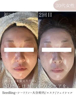 シードリン 府内店 小波のヘアスタイル