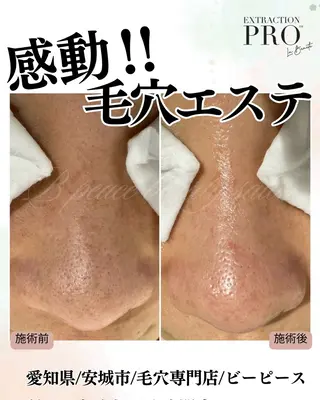 B peace. はるかのマツエク・マツパデザイン