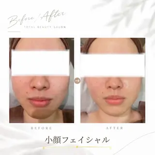 《 肌質×美肌 》 addissimoのエステ・リラクイメージ