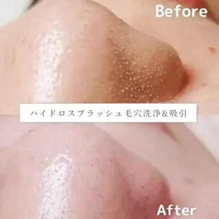 ☆ブライトサロン☆ 東瑞希のエステ・リラクイメージ