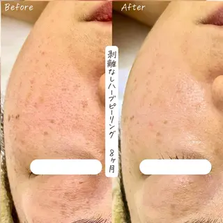 肌質改善サロン renew/ウエキのエステ・リラクイメージ