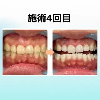 ホワイトニング シャトンのその他イメージ