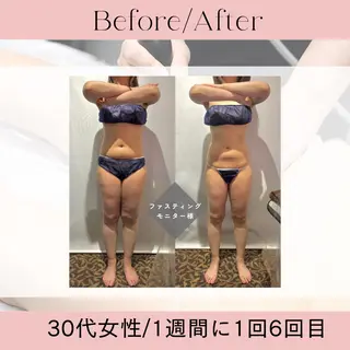 痩身&小顔サロン エクストリミティのエステ・リラクイメージ