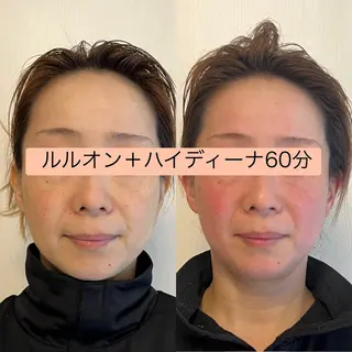 YOSAPARK jela 橋本のエステ・リラクイメージ