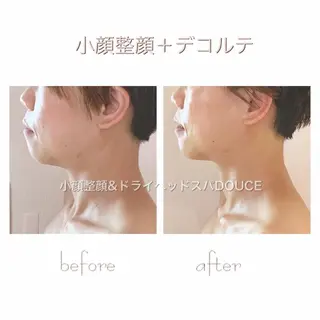 小顔＆美肌 Re :setのエステ・リラクイメージ