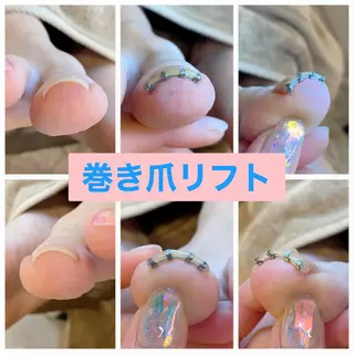 ネイル ♢ME2ROOM♢ #巻き爪#リラクのネイルデザイン