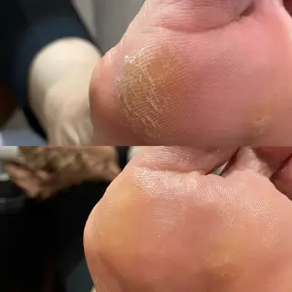 ネイル 自爪育成・巻き爪 補正講師 津蔵のネイルデザイン