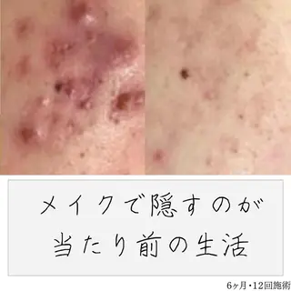 ニキビ経験者が施術 する専門サロン🌻のエステ・リラクイメージ