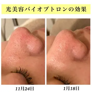 Bellesthe (ベルエステ)のエステ・リラクイメージ