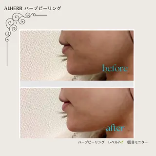 ハーブピーリング専門 店⭐︎AI.HERBのエステ・リラクイメージ