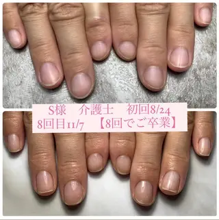 ネイル 自爪育成/深爪矯正 mikiのネイルデザイン