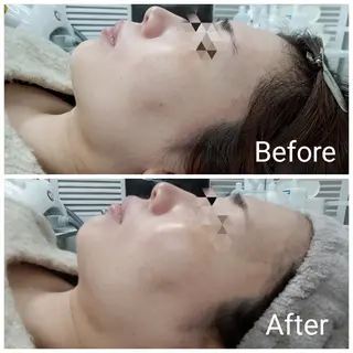 肌質改善Beauty salon Renのエステ・リラクイメージ