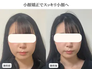 小顔矯正×毛穴サロン DRRAMSPA町田のエステ・リラクイメージ