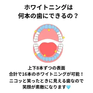 ホワイトニング ショップ津店のその他イメージ