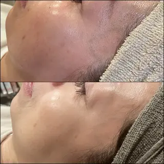 LiZA エステティックサロンのエステ・リラクイメージ