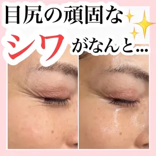 中目黒ハーブピーリン グ🌿ララピールのエステ・リラクイメージ