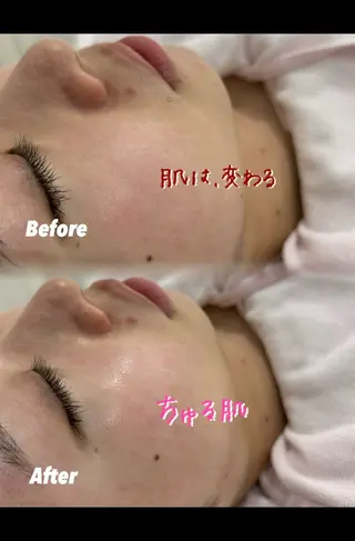 🫧美しい素肌へ🫧 今成柚乃のその他イメージ