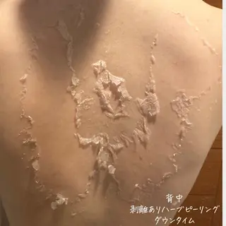 肌質改善サロン renew/ウエキのエステ・リラクイメージ