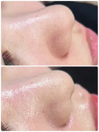 SalonJewel 品川店のエステ・リラクイメージ