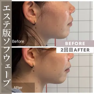小顔矯正・美肌ケア 池田 桃花のエステ・リラクイメージ