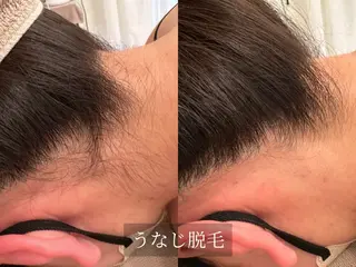 脱毛サロン Arumのエステ・リラクイメージ