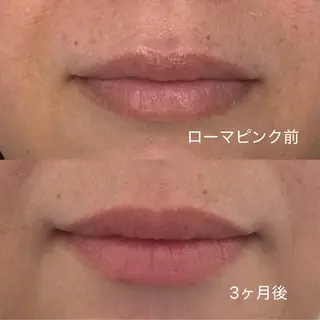 肌質改善サロン and...のエステ・リラクイメージ