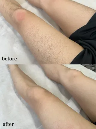 メンズ 瀬戸 梨子のネイルデザイン