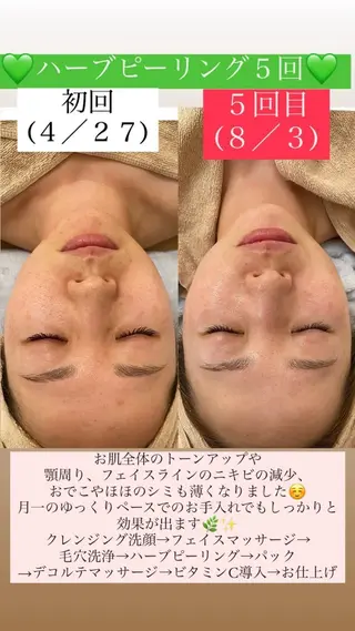 メンズ Salon de Lino 御器所のエステ・リラクイメージ