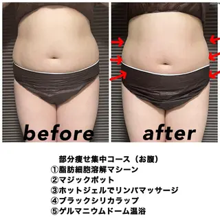 ネイル・エステサロン UILANIのエステ・リラクイメージ