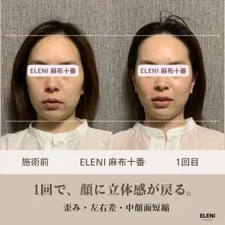麻布十番小顔コルギ 姿勢矯正リアン💗のエステ・リラクイメージ