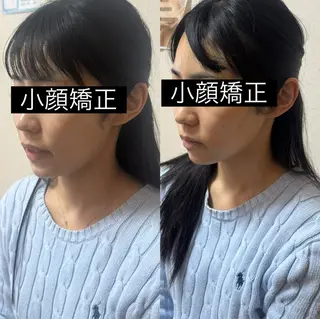 Lupinus 小顔矯正のエステ・リラクイメージ