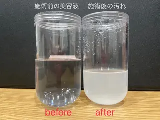 tliengle ［ﾄﾘｱﾝｸﾞﾙ］のネイルデザイン