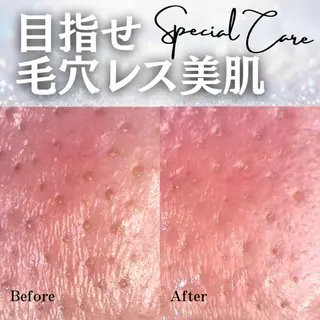 毛穴専門店Bebe 蘭のエステ・リラクイメージ
