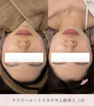 看護師が施術する美容 ナスサロshokoのエステ・リラクイメージ