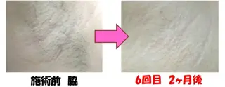 サロン リベル YUKAのエステ・リラクイメージ