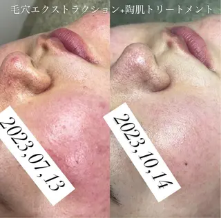 beauty salonWのエステ・リラクイメージ