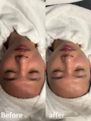 💎Queen Beauty🫧のエステ・リラクイメージ