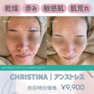 脱毛・肌質改善サロン Saphirのエステ・リラクイメージ