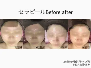 エステティックサロン Viveのエステ・リラクイメージ