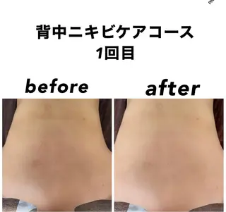 ネイル・エステサロン UILANIのエステ・リラクイメージ