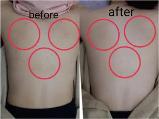 肌ケア&毛穴洗浄 Cheri/女性専用のエステ・リラクイメージ