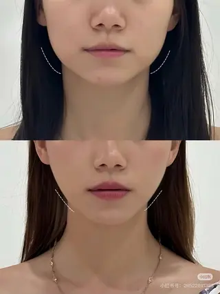 マツエク・マツパ 愛維美水光専門店 川崎彩鳳のエステ・リラクイメージ