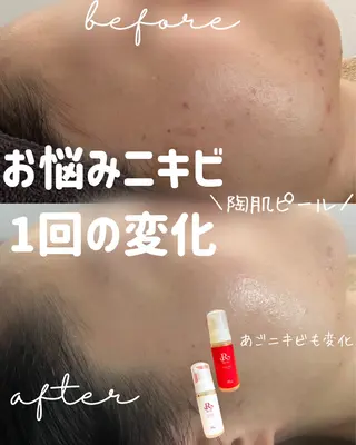 ｍｉkｉ 東根の肌質改善サロンのエステ・リラクイメージ
