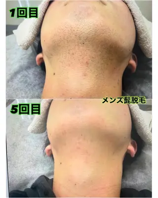 メンズ NR Nara yukiのエステ・リラクイメージ