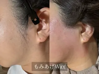 脱毛サロン Arumのエステ・リラクイメージ