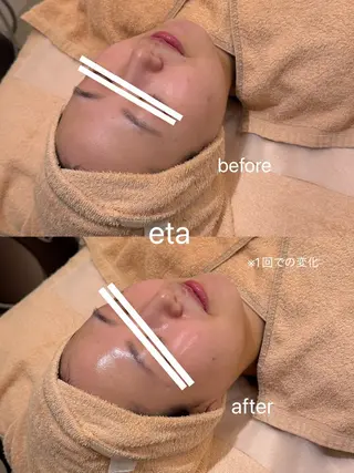 ロング 💋美ボディサロン eta【エタ】💋のエステ・リラクイメージ