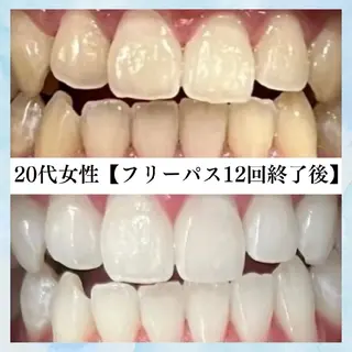 メンズ キッズ セルフホワイトニング WHITE福岡天神店のエステ・リラクイメージ