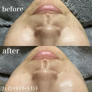 磐田|LAYLA 一番丁寧な脱毛店のエステ・リラクイメージ