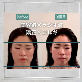 KANWA 鍼灸院のエステ・リラクイメージ