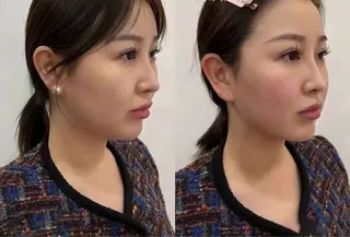 ネイル 愛維美水光専門店 川崎彩鳳のエステ・リラクイメージ